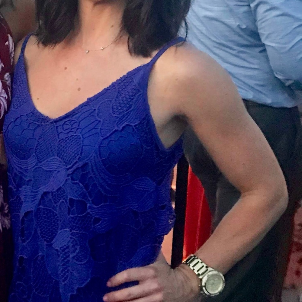 Express lace dress